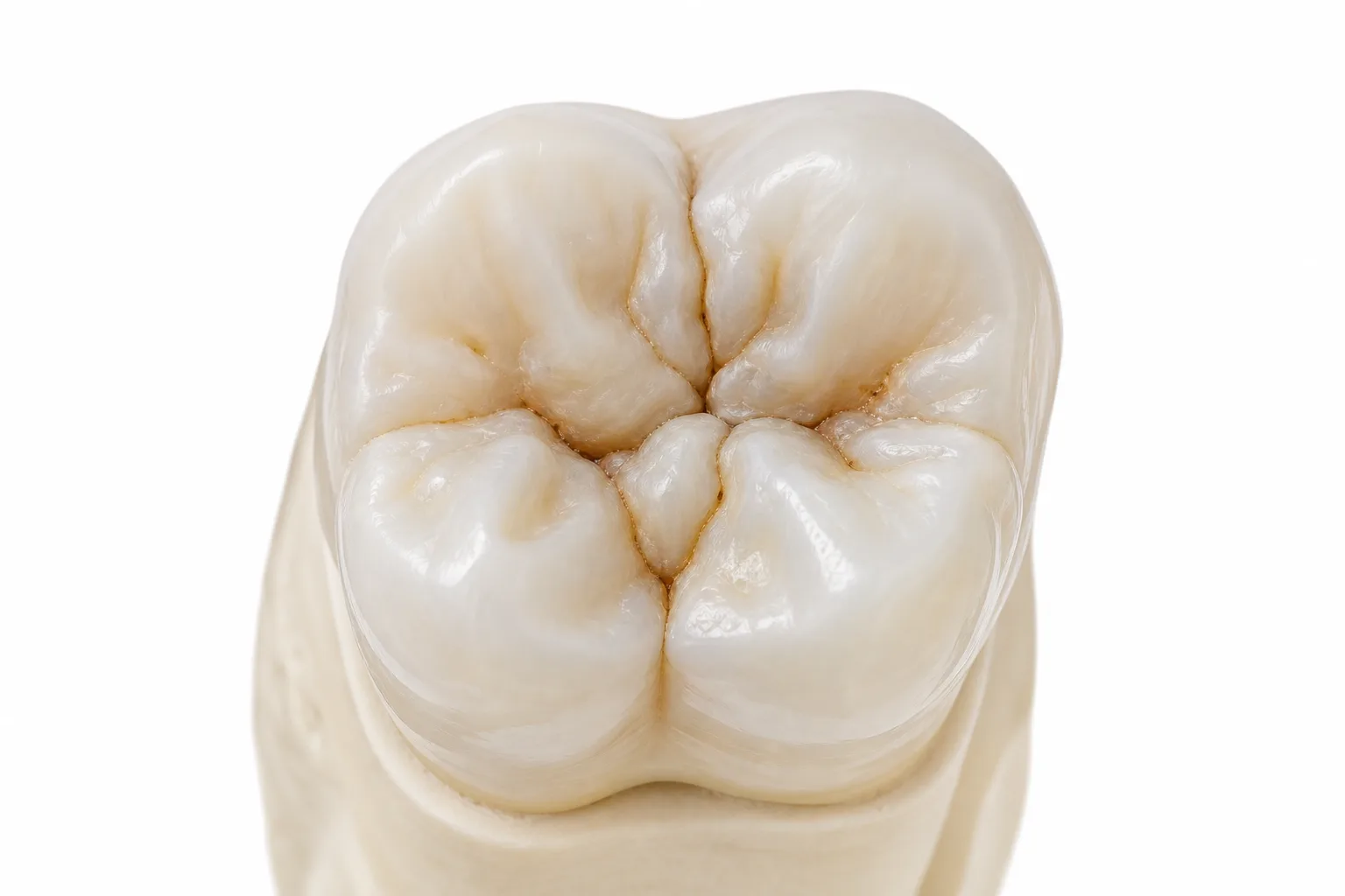 Sigilare dentară și prevenție carii Suceava